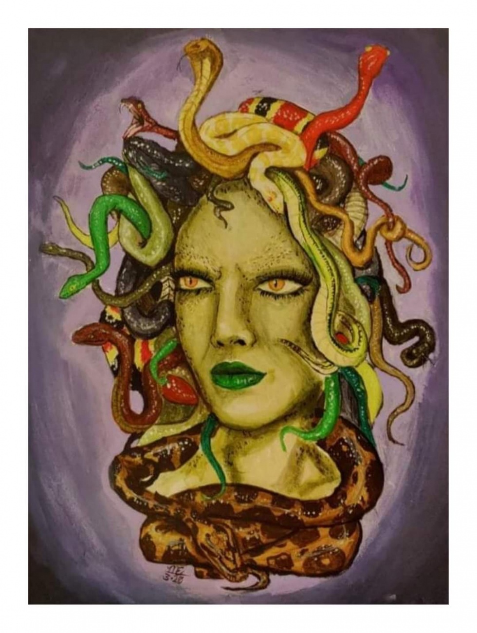 Medusa 